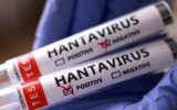 Hantavirüs’de son durum: Birçok ülke vatandaşlarını tahliye için bekliyor Hantavirüs’de son durum: Birçok ülke vatandaşlarını tahliye için bekliyor